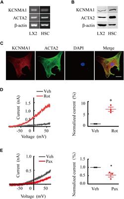 Activation of BK Channels Prevents Hepatic Stellate Cell Activation and Liver Fibrosis Through the Suppression of TGFβ1/SMAD3 and JAK/STAT3 Profibrotic Signaling Pathways